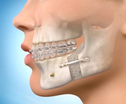 Chirurgie dentară – Megadent
