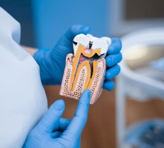 Terapie _ Endodonţie – Megadent